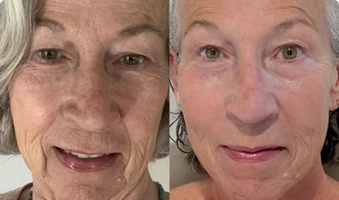 Fran, 64 años